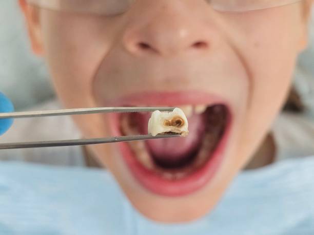 Best Emergency Pediatric Dentist  in Dogtown, CA
